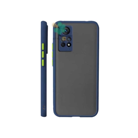 خرید قاب گوشی شیائومی Redmi Note 11 Pro مدل پشت مات محافظ لنزدار رنگ آبی